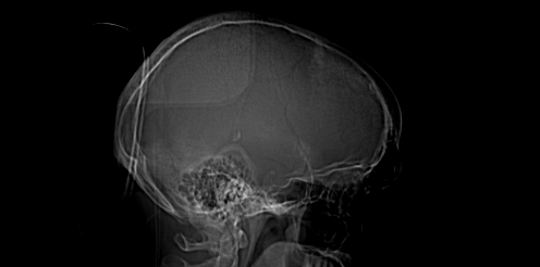 Fitness and Free&nbsp;Will